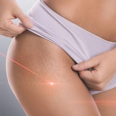 Stakur tími í LED húðmeðferð hjá House of Beauty 